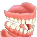 dental_dentures