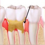 dental_gum_treatment